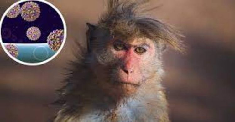 Sanidad confirma un caso de viruela del mono en Gran Canaria y notifica cinco nuevos en estudio