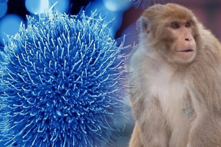 Sanidad eleva a 84 los casos confirmados de viruela del mono en España