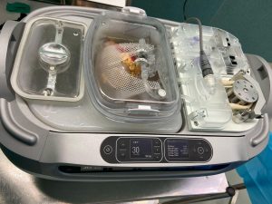 maquina-perfusion-renal6-300x225-1