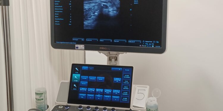 Sanidad adjudica dos ecógrafos por más de 216.00 euros para los hospitales Doctor Negrín y de La Candelaria