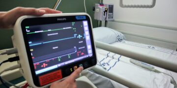 El SCS registra 2.678 ingresos por ictus en las unidades hospitalarias especializadas en 2024