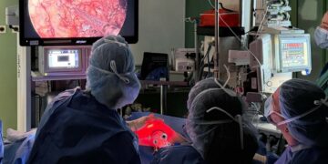 El Hospital La Candelaria realiza su primera mastectomía por endoscopia para tratar el cáncer de mama