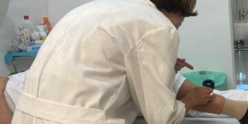 Los dermatólogos del HUC participan en la campaña Euromelanoma