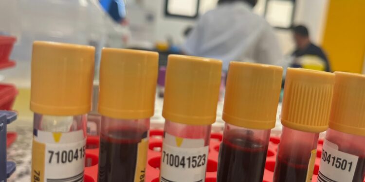 Sanidad comienza a administrar la terapia génica para la Hemofilia B