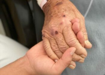 Un total de 94 personas se acogen en Canarias a la prestación de ayuda a morir desde 2021