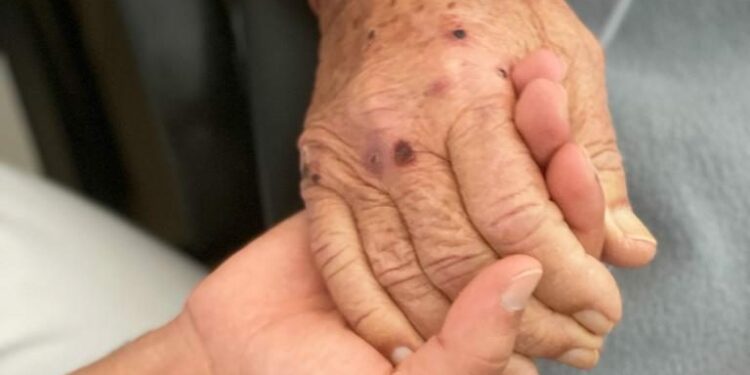 Un total de 94 personas se acogen en Canarias a la prestación de ayuda a morir desde 2021