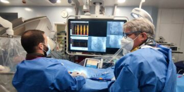 El Hospital La Candelaria ha empleado la ablación pulsada en 175 pacientes que padecen fibrilación auricular