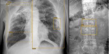 Sanidad saca a licitación la instalación de 18 salas de radiodiagnóstico en hospitales del SCS por 6,3 millones