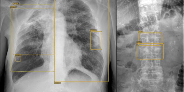 Sanidad saca a licitación la instalación de 18 salas de radiodiagnóstico en hospitales del SCS por 6,3 millones